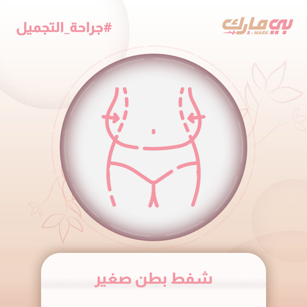 شفط بطن صغير