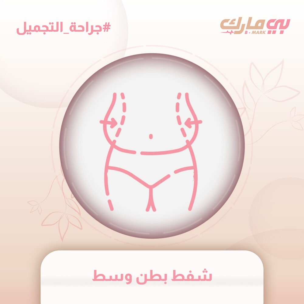 شفط بطن وسط