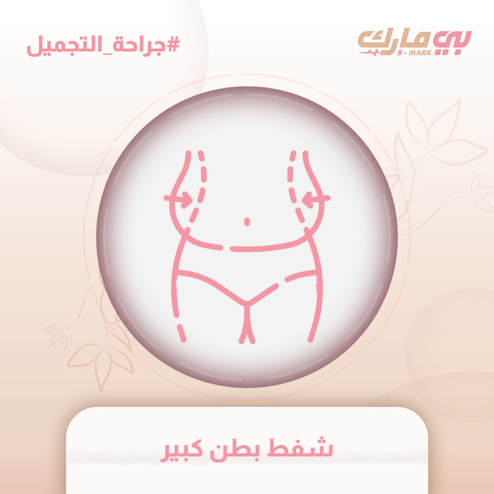 شفط بطن كبير