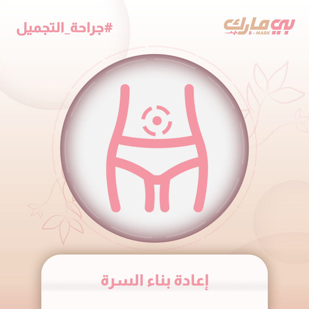 إعادة بناء السرة