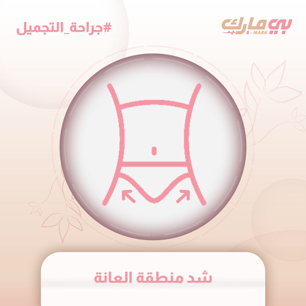شد منطقة العانة
