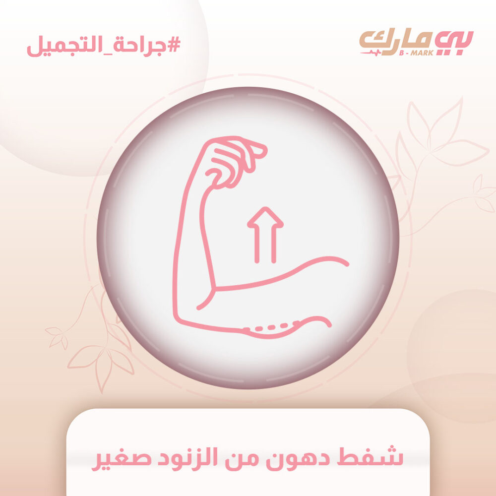 شفط دهون من الزنود صغير