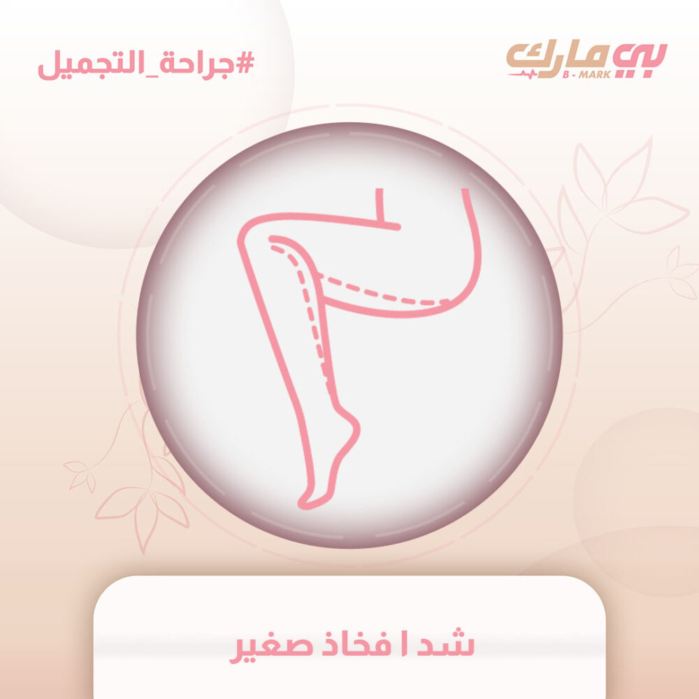 شد ا فخاذ صغير