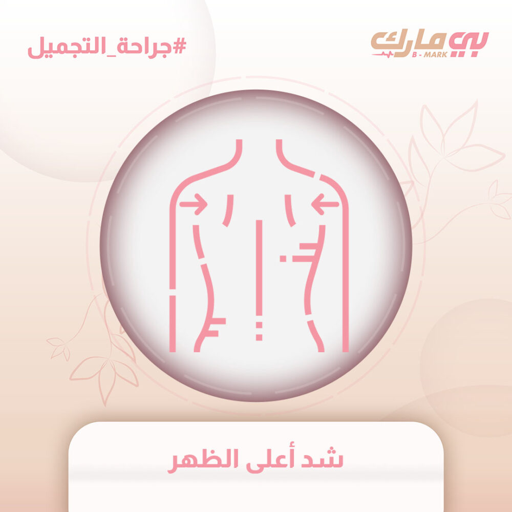 شد أعلى الظهر