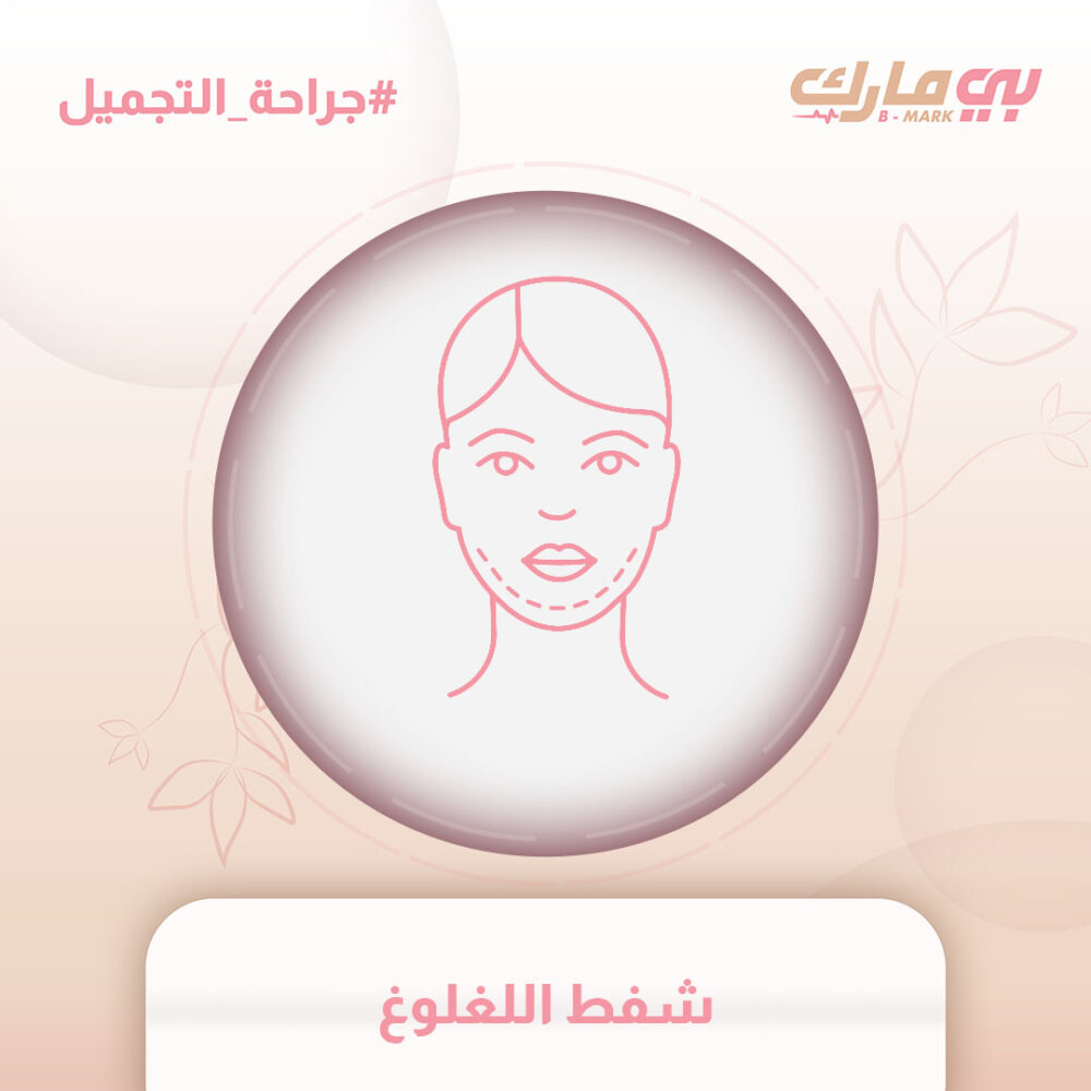 شفط اللغلوغ