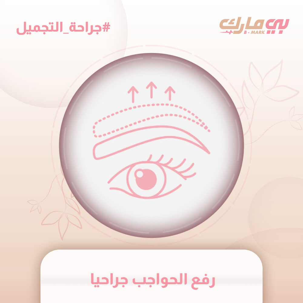 رفع الحواجب جراحيا
