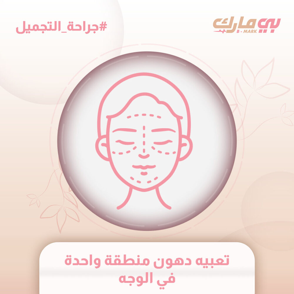 تعبيه دهون منطقة واحدة في الوجه