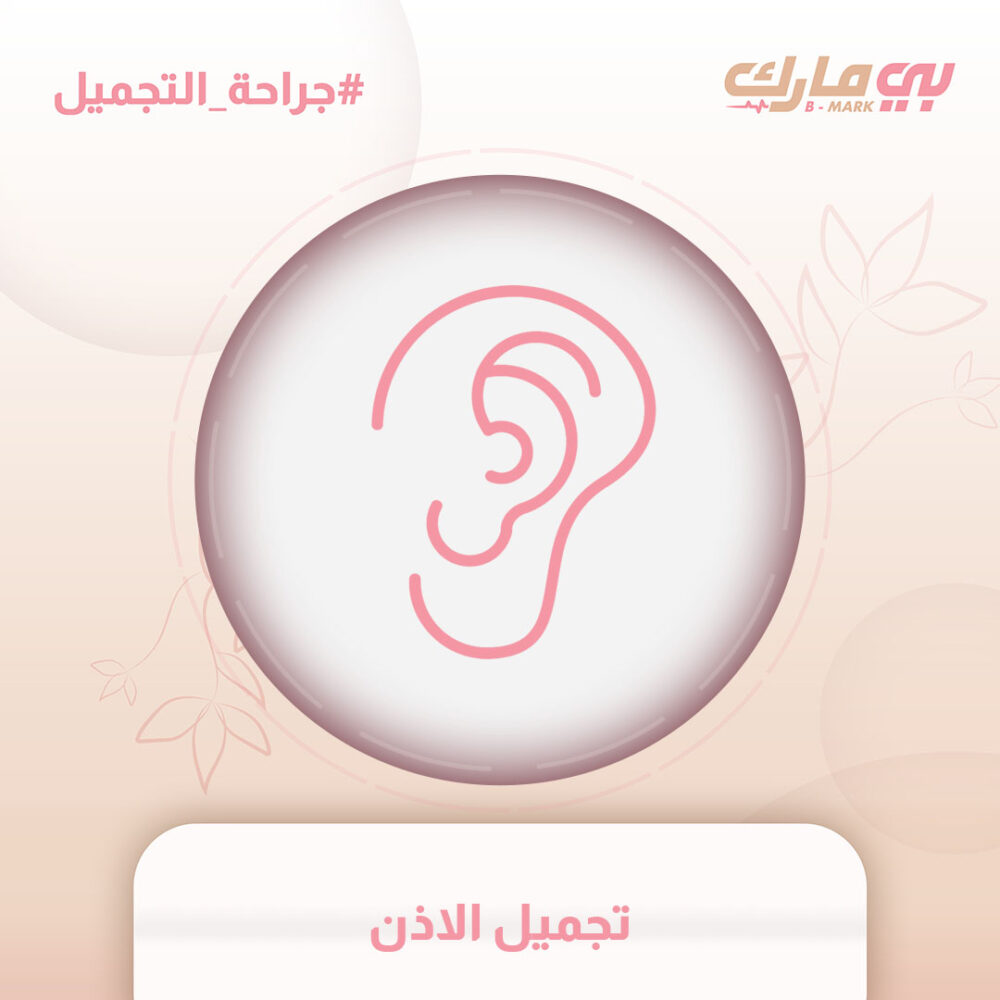تجميل الاذن