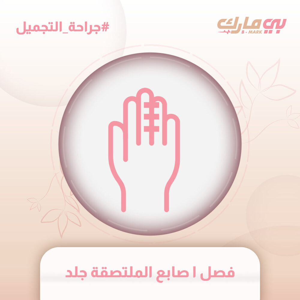 فصل ا صابع الملتصقة جلد
