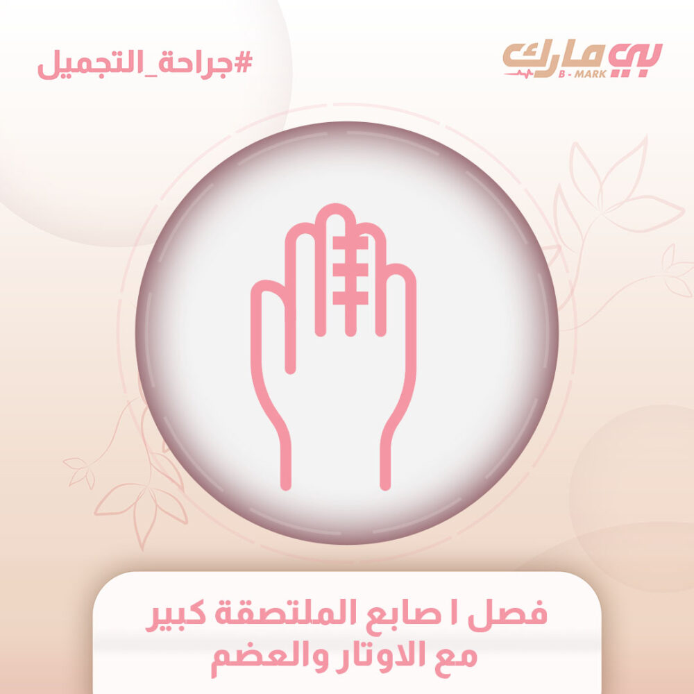 فصل ا صابع الملتصقة كبير مع الاوتار والعضم