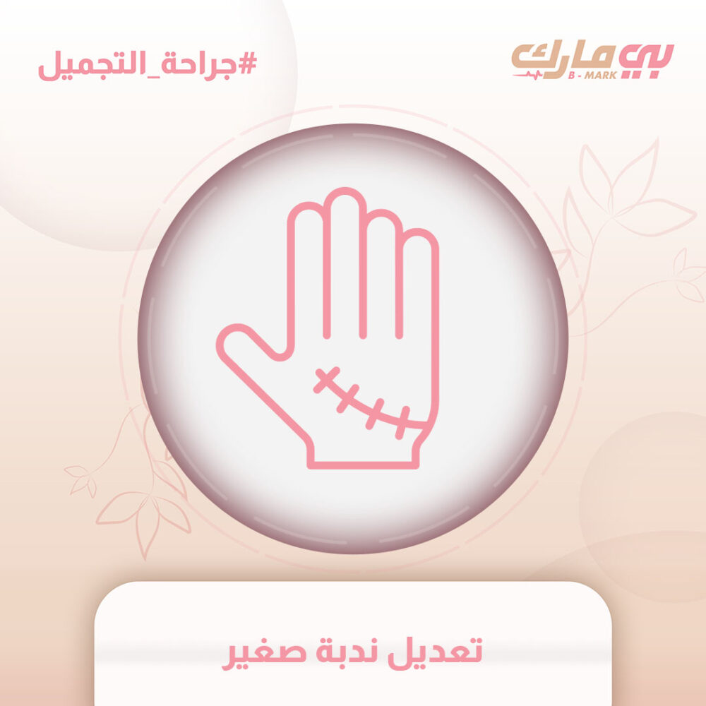 تعديل ندبة صغير