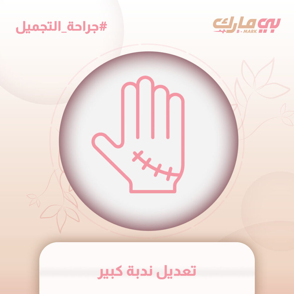 تعديل ندبة كبير