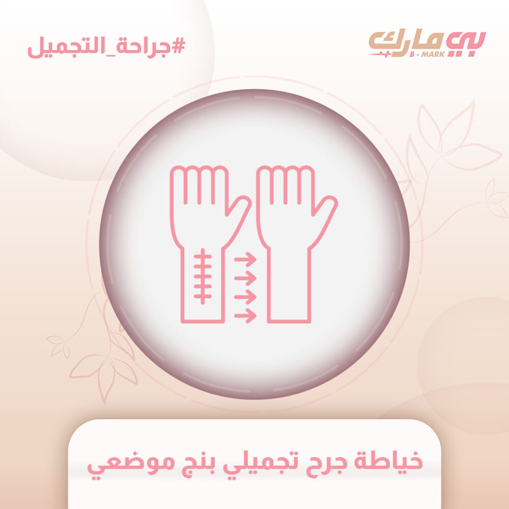 خياطة جرح تجميلي بنج موضعي