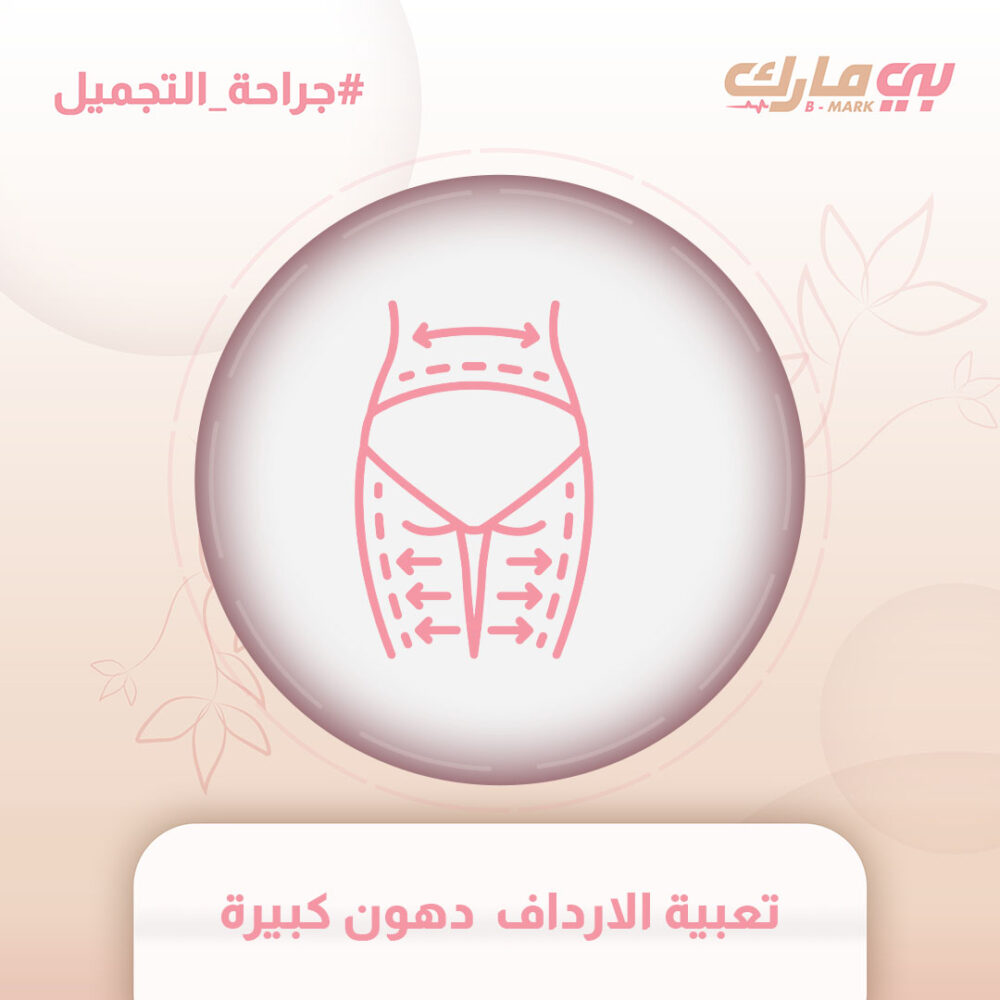 تعبية الارداف  دهون كبيرة