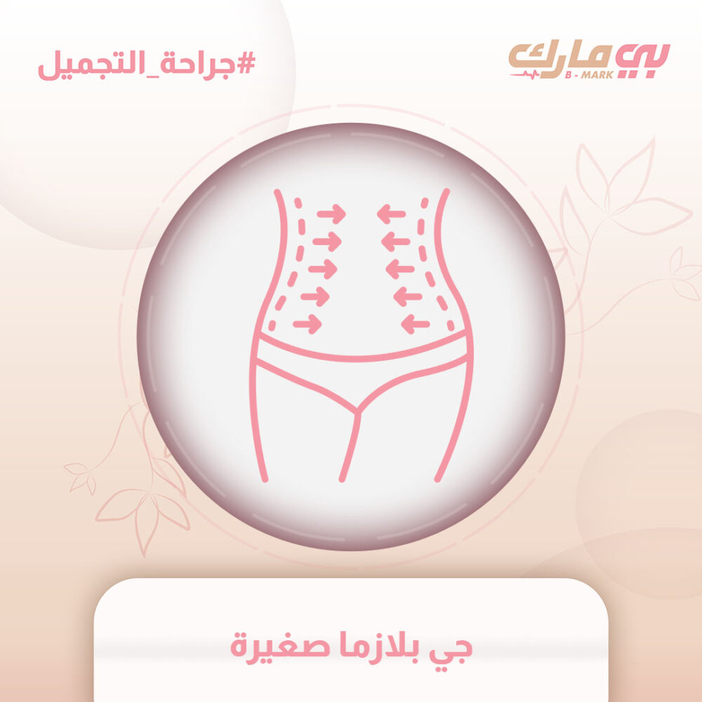 جي بلازما صغيرة