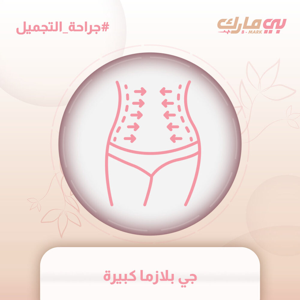جي بلازما كبيرة