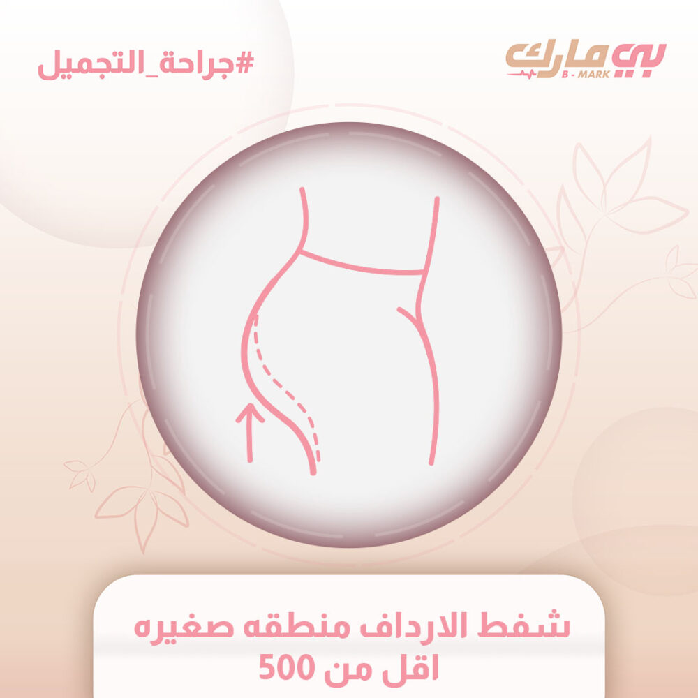 شفط الارداف منطقه صغيره اقل من 500