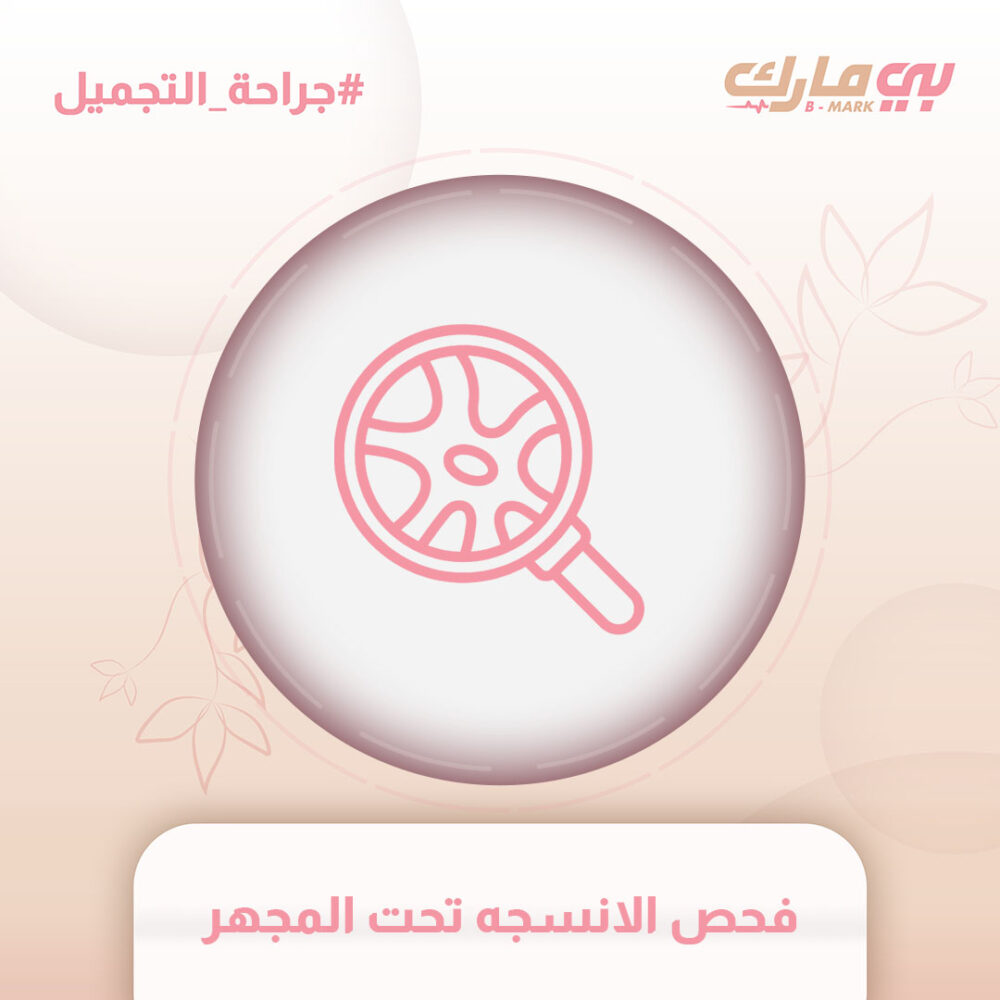 فحص الانسجه تحت المجهر