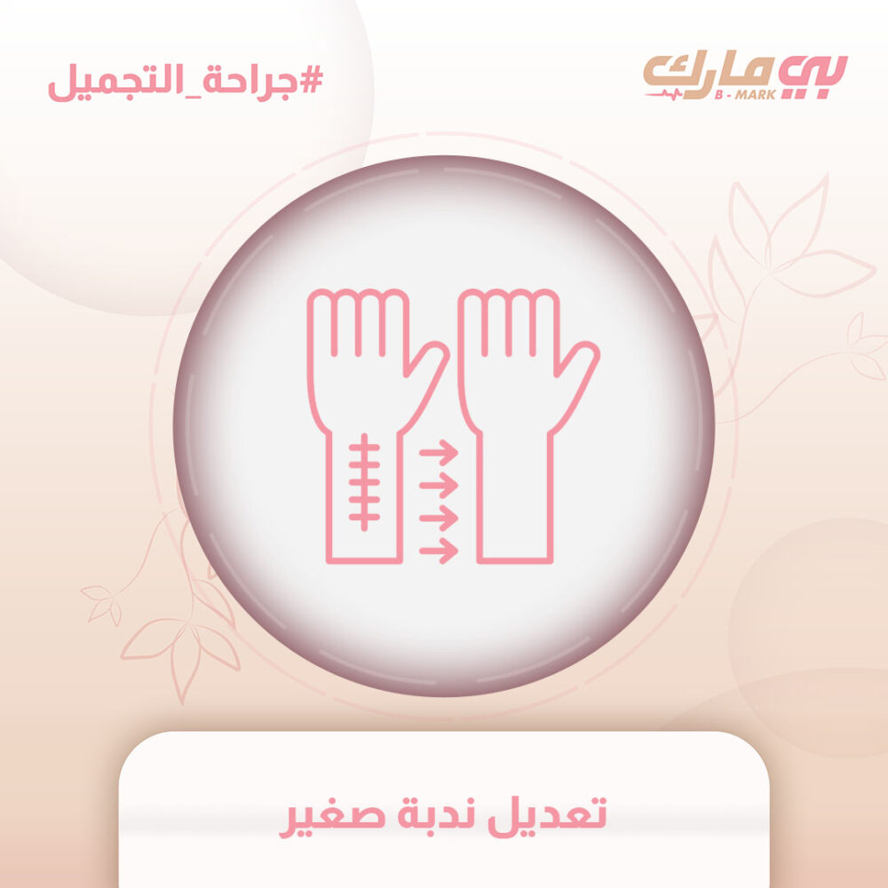تعديل ندبة صغير