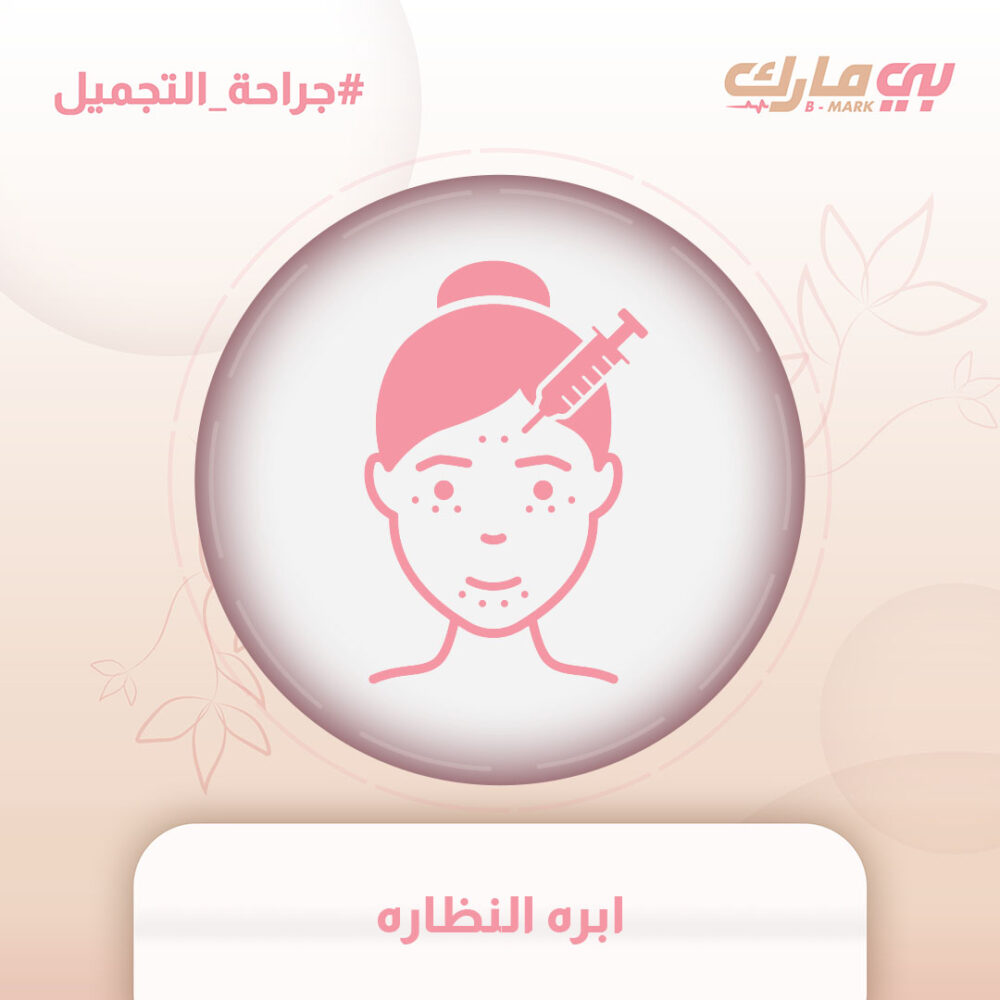 ابره النظاره