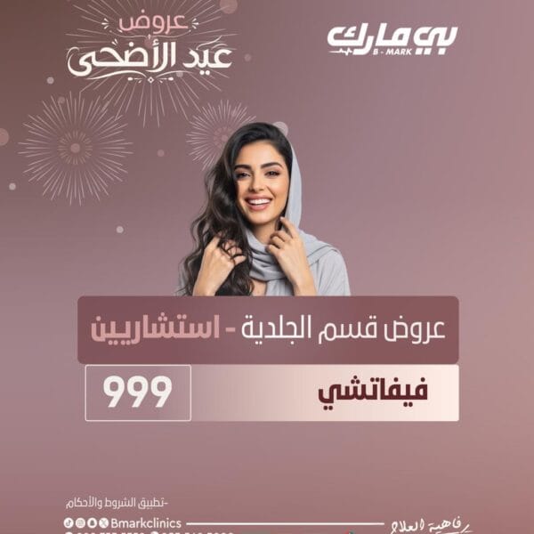 فيفاتشي