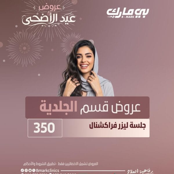 جلسة ليزر فراكشنال