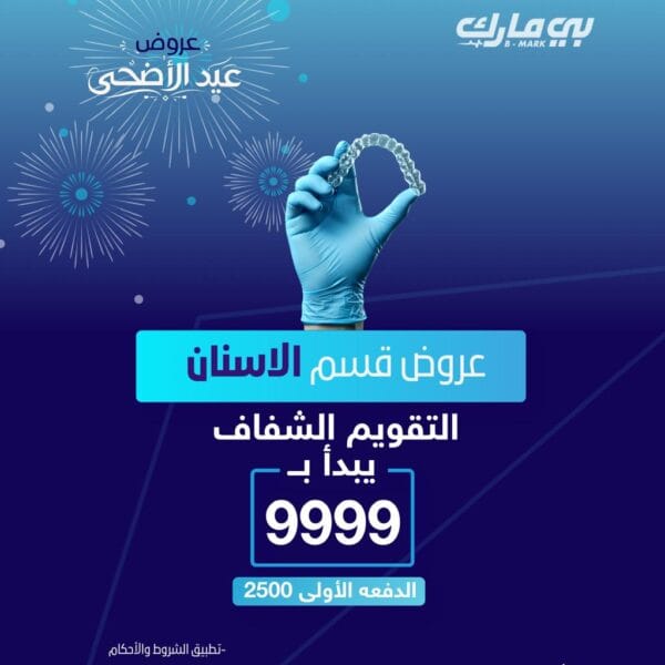 التقويم الشفاف الذكي