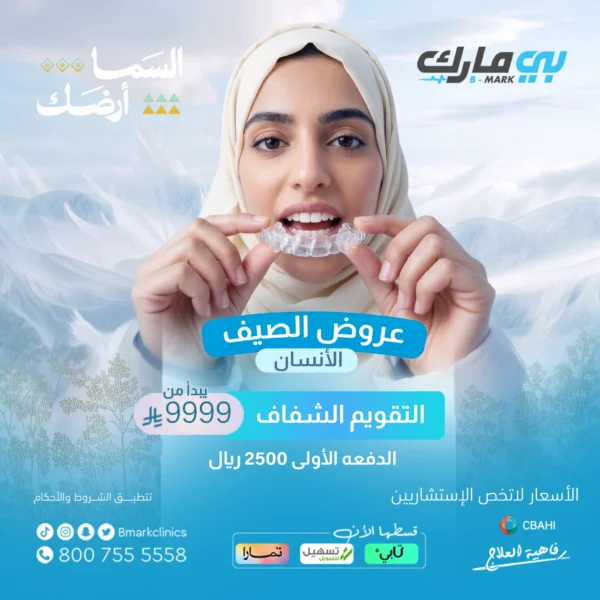 التقويم الشفاف