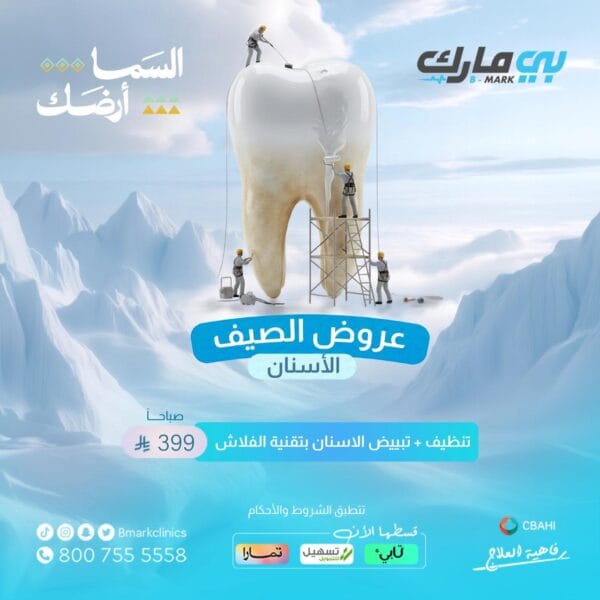 تنظيف + تبييض الاسنان بتقنيه الفلاش (صباح)
